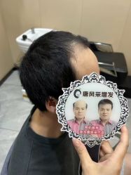 -唐风采假发补发定制