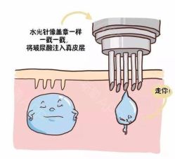 -上海玫瑰医疗美容医院