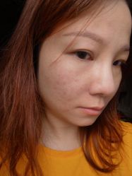 体验后-伊丽莎白医疗美容