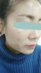 点击看大图 -北京美痣堂古方祛痣斑疣瘊