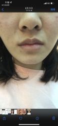 点击看大图 体验前-上海时光整形外科医院