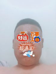 体验后-北京叶子整形美容医院