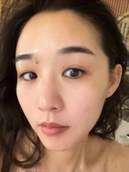 -宥莉·ULLY 痘敏肌•科技皮肤管理中心