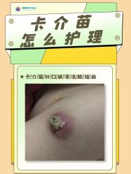 -明昇月子中心(番禺万达广场店)