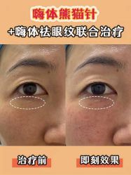 -长沙雅美医疗美容医院