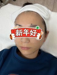 -北京叶子整形美容医院
