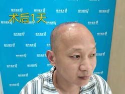 -雍禾植发全国连锁