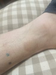 -净肤洗纹身