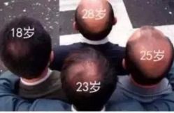 -极客侠男士假发定制补发