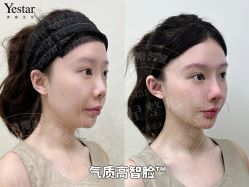 -Yestar艺星整形美容医院
