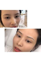 -久匠半永久纹眉
