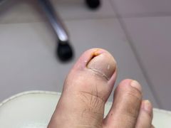 -新甲连锁灰指甲·甲沟炎·鸡眼(黑龙江路店)