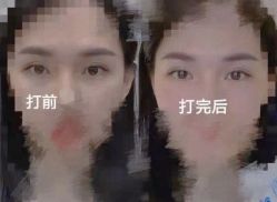 -CMS西美斯·美式医疗美容