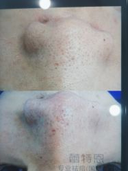 点击看大图 -蕾特恩专业祛痘·皮肤管理
