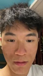 体验后-重庆军科整形美容医院