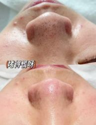 -春田皮肤管理中心品牌旗舰店