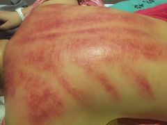 -正清和·推拿养生(黑石礁中心店)