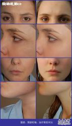 点击看大图 3-钎赫造型