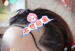 -大麦微针植发全国连锁