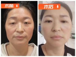 -素美医疗美容·西南眼鼻整形·修复基地