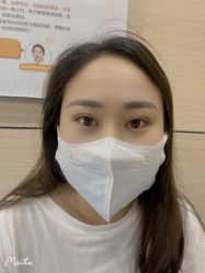 体验后-重庆联合丽格第五医疗美容医院