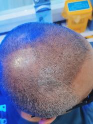 -雍禾植发全国连锁