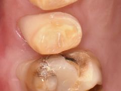 -精德口腔·种植修复·儿牙中心(财富中心店)