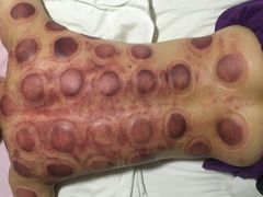 -正宜按摩养生坊(建设局店)