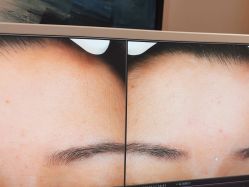 -苑苑vbeauty科技美容SPA