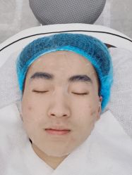 -悟空祛痘·诺奖技术专业店