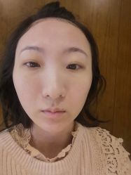 体验后-厦门美莱整形美容医院