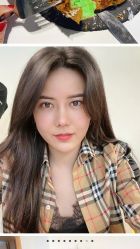 -大麦微针植发丨全国连锁