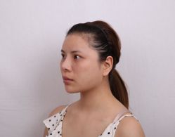 -深圳悦她医疗美容