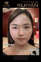 -黎蓓露·徒手骨雕蛋白抗衰·调肤管理