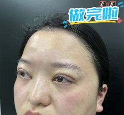-素美医疗美容·西南眼鼻整形·修复基地