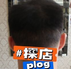 -大麦微针植发丨全国连锁