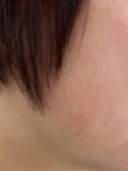 -广州美莱医疗美容医院