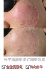 -E.beauty驻颜·痘敏肌调理中心
