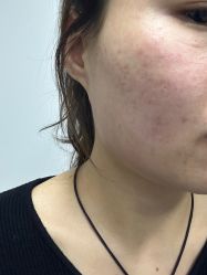 -海涛医疗美容·面部抗衰·注射美鼻