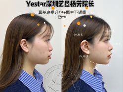 -深圳艺星医疗美容医院