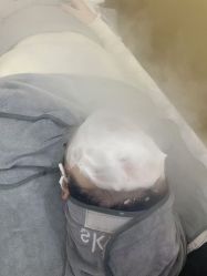 -skin79皮肤管理中心