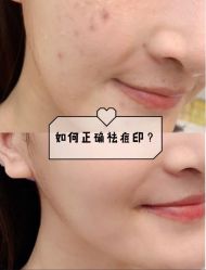 -苗方清颜痘肌研究所