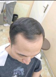 -唐风采假发补发定制