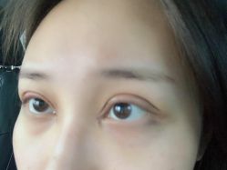 体验后-上海玫瑰医疗美容医院