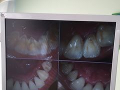 -和平卓尔口腔·矫正种植中心