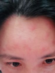 体验后-上海玫瑰医疗美容医院