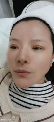-郡艺医疗美容·微整·眼鼻吸脂