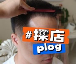 -大麦微针植发丨全国连锁