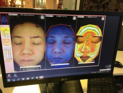 皮肤检测-光SPA科技美肤