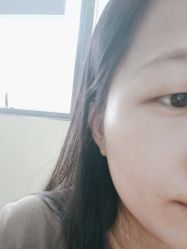 体验后-深圳医恒美医疗美容